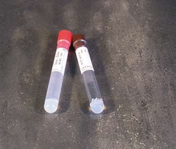Provette con gel separatore per 10 ml di sangue – PMMA - Con etichetta - tappo marrone