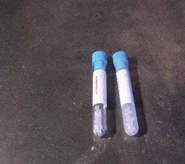 Provette con granuli separatori e acceleratore della coagulazione per 4 ml di sangue – Polipropilene - Con etichetta - tappo azzurro