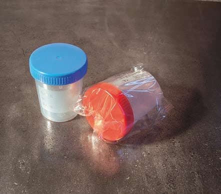 Contenitore urine da 150 ml – Con tappo a parte, tappo azzurro