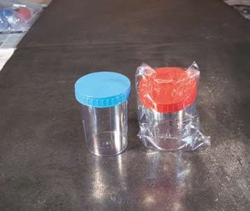 Contenitore urine da 150 ml – Sterile, confezione singola, tappo rosso