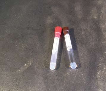 Provette con gel separatore e acceleratore della coagulazione per 5 ml di sangue – PMMA - Con etichetta - tappo marrone