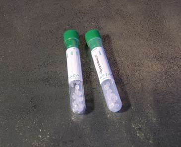 Provette con granuli separatori per 4 ml di sangue – Polipropilene - Con etichetta - tappo verde
