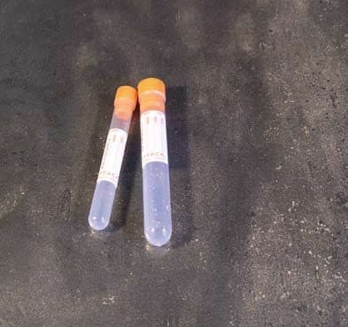Provette con KF + Na2 EDTA - tappo arancione – KF+Na2 EDTA per 2,5 ml di sangue - provette Ø 12 x 86 mm