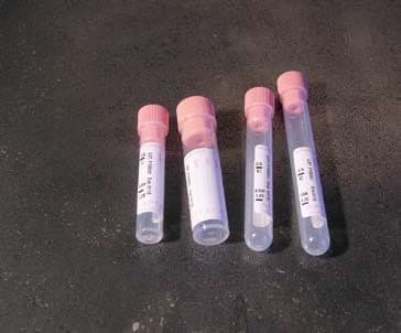 Provette con sodio citrato 0,25 ml – Sodio citrato 0,25 ml - provette Ø 12 x 56 mm