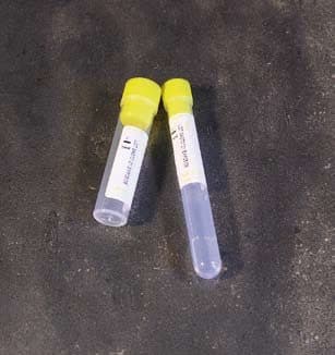 Provette con sodio citrato 0,5 ml - tappo giallo per coagulazione – Sodio citrato 0,5 ml - provette Ø 12 x 86 mm