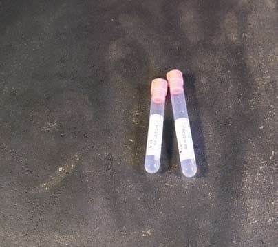 Provette con sodio citrato 0,25 ml - tappo rosa per VES – Sodio citrato 0,25 ml - provette Ø 12 x 86 mm